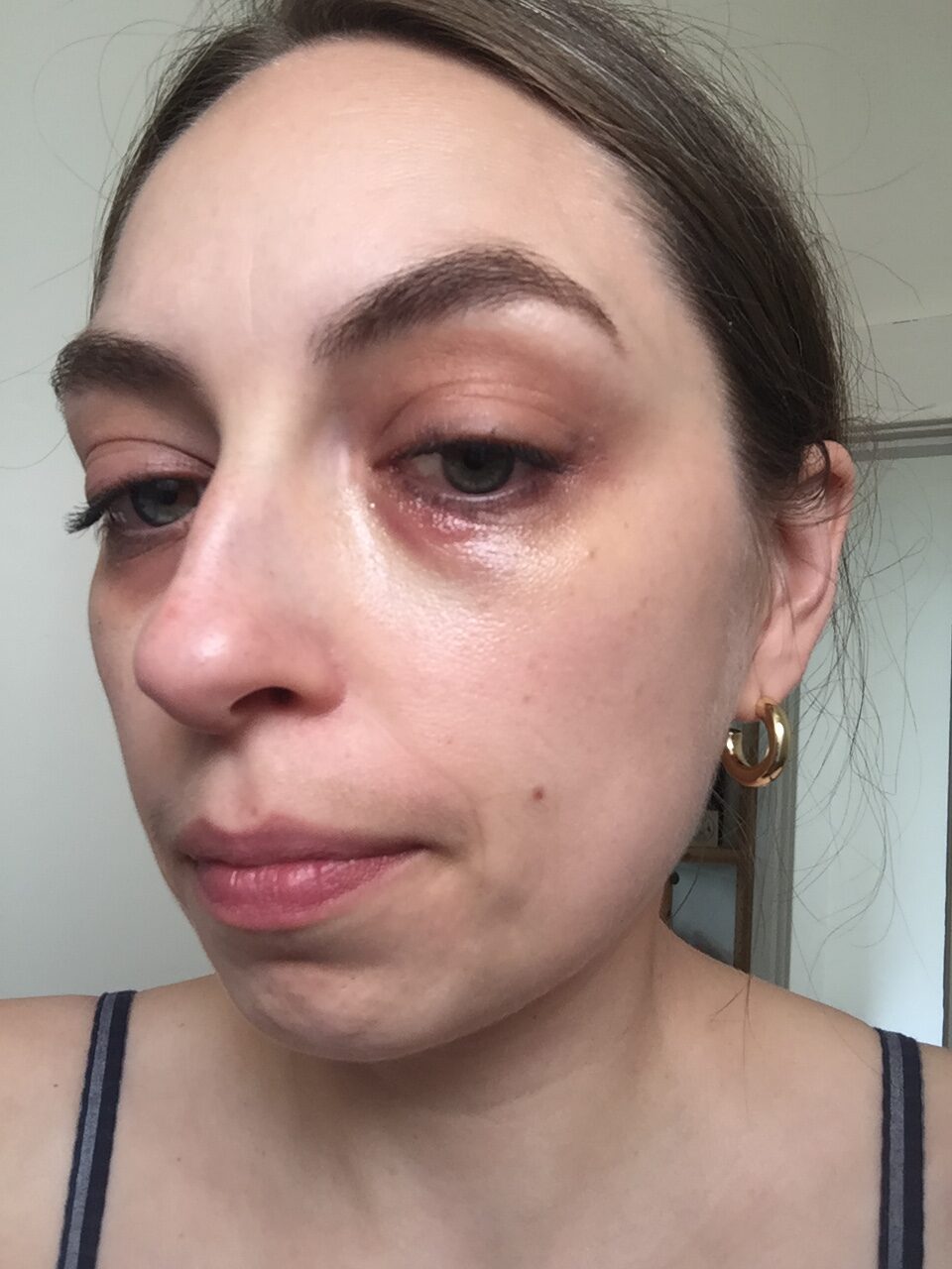 Woman Hit By A Driver On SE Hawthorne Reflects On Infrastructure